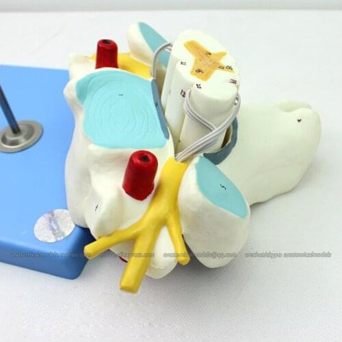 CMAM/12393 Cervical vertebra, Medical Backbone Anatomical Human Model