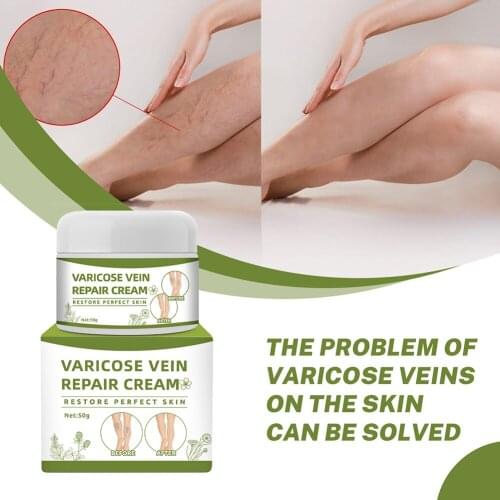 Varicose Vein Cream Relieve Pain Antibacterial Safflower Cream Legs Repair Vein Cream 50g