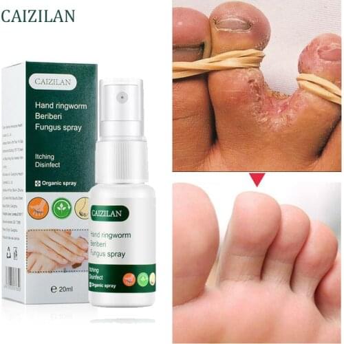 LANBENA Foot Gels