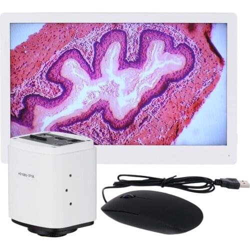 AmScope 1080p 60fps HDMI Microscope Camera + HD Monitor HD1080-HDM