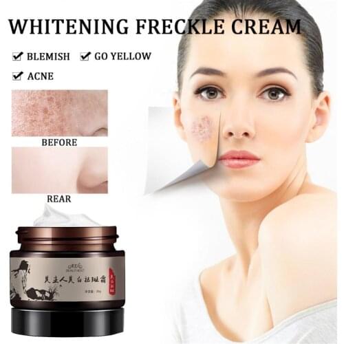 Freckle Removal Whitening Cream Strong Effects Whitening Anti Wrinkle Cream Freckle Artifact Remove Acne Spots Face Care TSLM1