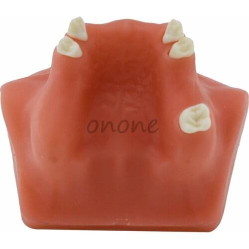 1pcs Maxillary Sinus Elevation Tooth Model Bone Imitating Oral Teaching Aids Dental Implant Placement Exercise Prop