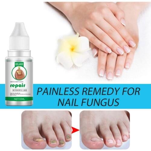 10/20/30ml EELHOE Nail Treatment Liquid Harmless Lightweight Plant Extracts Fungus Removing Manicure Repair Essence for Foot