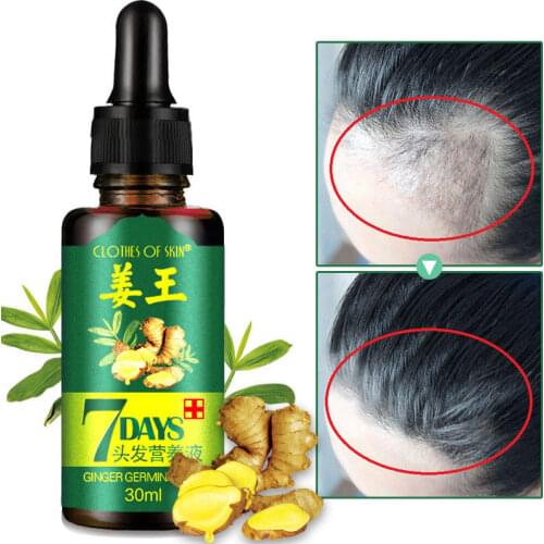 Ginger Germinal Serum Essence Oil Hair Loss Treatement Growth Hair Repair Liquid Growing Faster Hair Care