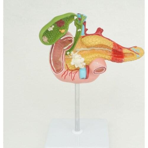 Human Anatomical Duodenum Gall Bladder Disease Anatomy Medical Model Teaching Resources