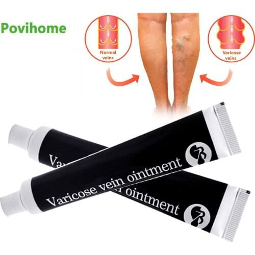 1Pcs Varicose Veins Treatment Cream Cure Vasculitis Phlebitis Spider Veins Pain Relief Varicosity Angiitis Anti-swelling Ointmen