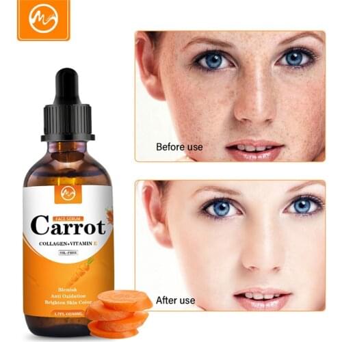 Minch Dark Spot Corrector Carrot Extract Face Serum Whitening Brighten Blemish Freckle Remover Natural Essence Korea Skin Care
