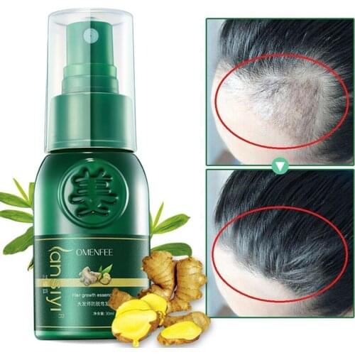 50ml Ginger Hair Growth Spray Serum Anti Hair Loss Products Fast Grow Prevent Hair Dry Frizzy Damaged Thinning Repair Care