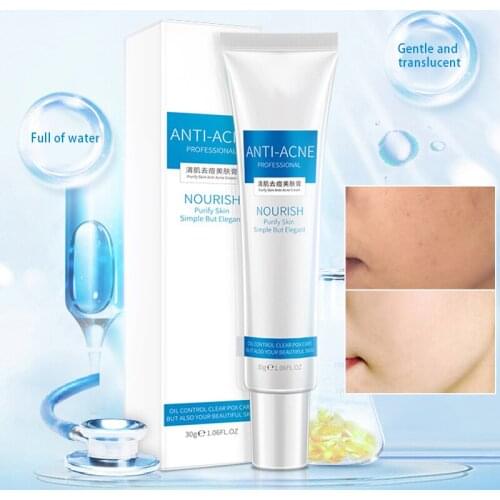 Blemish Cream Spots Removal Treatment Pimple Ointment Scar Mark 30g Oil Control Moisturizing SSwell