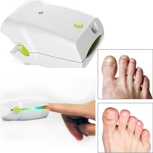 Toenail Repair Nail Fungus Cleaning Laser Therapy Physiotherapy Anti Fungal Treatment Onychomycosis Paronychia Infection