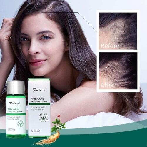 PUTIMI 20ml Anti Hair Loss Hair Growth Serum Regeneration Repair Essential Oil Grow Hair Loss Treatment Product for Men Women
