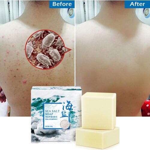 ROSPSKL Facial Cleansers