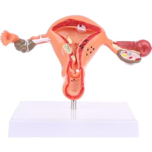 2021 New PVC Pathological Uterus Ovary Anatomical Model Anatomy Cross Section Study Tool