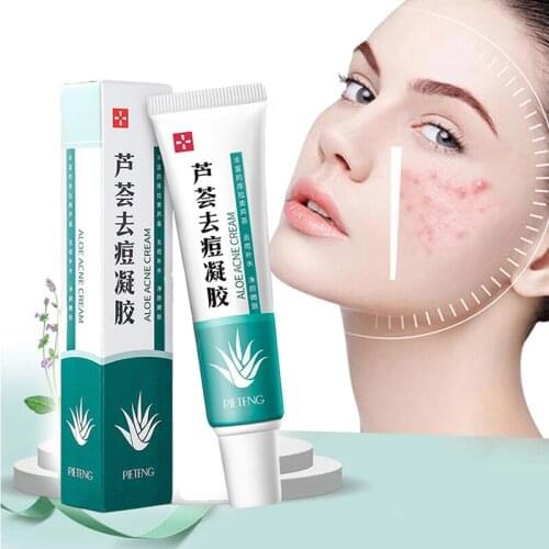 Effective Acne Removal Cream Acne Treatment Fade Acne Spots Oil Control Shrink Pores Whitening Moisturizing Acne Cream Skin Care
