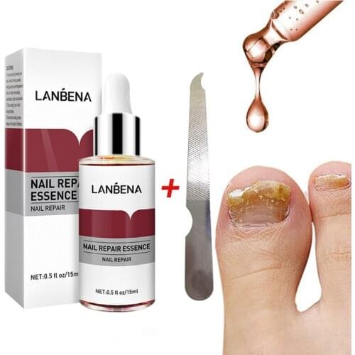 Bright Fungal Nail Repair Onychomycosis Removal Essence Anti Infection Foot Nail Care Nail Treatment Cream Foot Care
