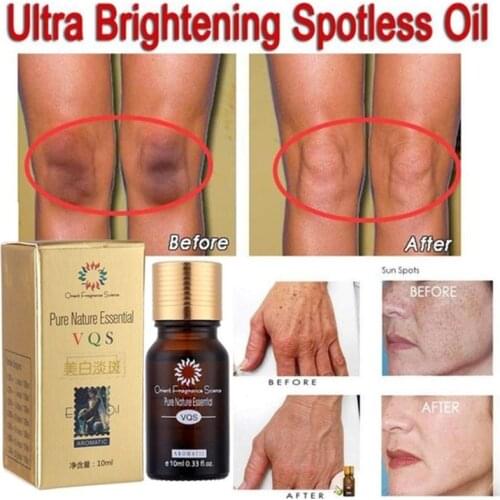 Ultra Brightening Spotless Essence Natural Skin Care massage essential oil Removal Dark Spots Burn Marks & Scars Repair serum