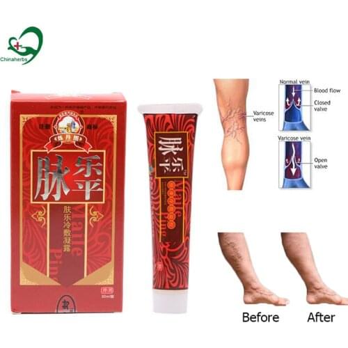 5 Box Varicose Plaster Treatment Cream Vasculitis Phlebitis Spider Veins Pain Angiitis Remedy Removal Herbal Ointment