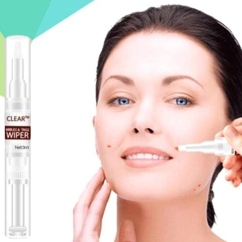 3ml Wipeoff Tags & Moles Remover Liquid Genital Wart Removal Treatment Pen Skin Beauty Removing Callus Warts Eye Corns Pencil