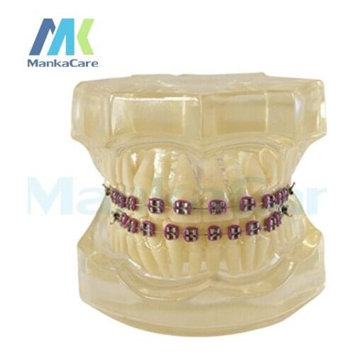 Manka Care - 28 pcs Tooth, all metal bracket Oral Model Teeth Tooth Model