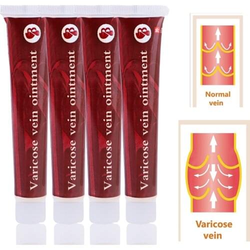 100% Original Medicine PlasterTreatment Spider Veins Varicose Ointment Varicose Veins Vasculitis Health Care Cream