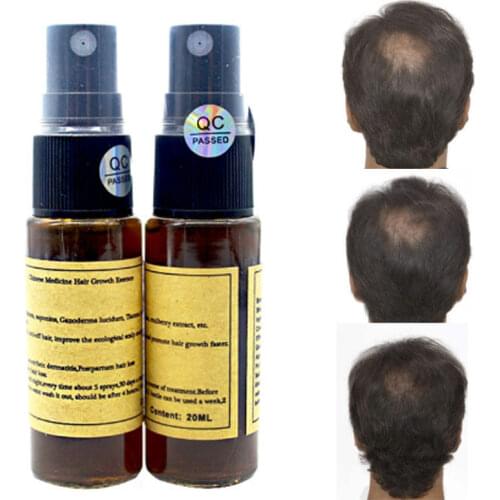 Okenys Hair Tonic for Hair Loss Remedies Fast Hair Growth Products for Woman Man, Hair Regrowth, Yuda Pilatory Treatment 20ml