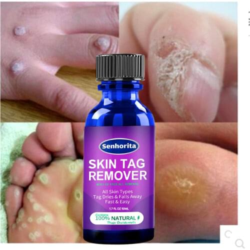 Инструменты для чистки лица 7Days China At AliExpress