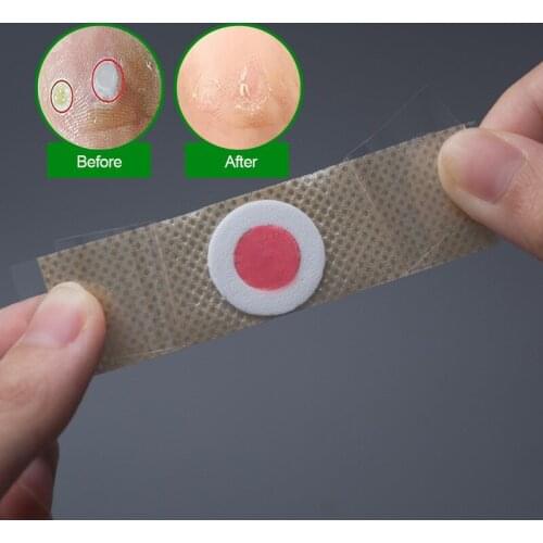 42pcs Foot Corn Killer Calluses Plantar Warts Thorn Pain Relief Plaster Foot Care Tool Medical Sticker Toe Protector Corn Cure