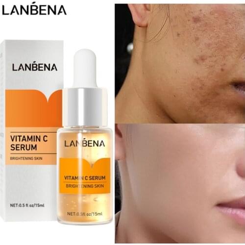 LANBENA Vitamin C Whitening Face Serum Lighten Spots Brightening Facial Skin Essence Fade Dark Spots Remove Freckle Speckle Care