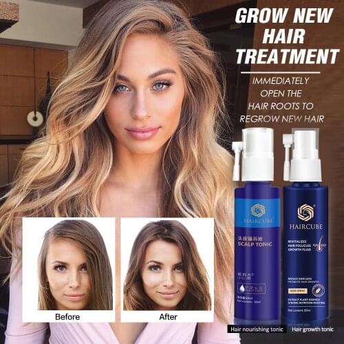 Hair Growth Essence Oil Spray for Hair Regrowth Oil Anti Hair Loss Hair Growth Serum liquid Hair Loss Treatment Hair Tonic