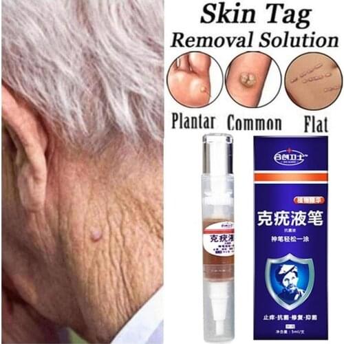 Ultra Strength Skin Tag Remover Liquid Pen Foot Corn Skin Tag Mole Genital Wart Remover 12hours Tu Kill Medical Tools Useful 5ml