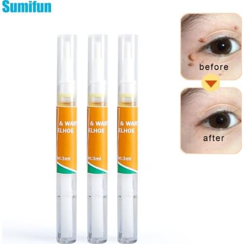 1pcs Against Mole Genital Wart Remover Removal Papillomas Rapidly Removes Mole Anti Foot Corn Skin Tag Remover Pen Health Care