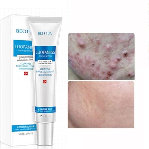 30g Face Skin Acne Treatment Day Cream Whitening Brightening Shrink Pores Gel Facial Beauty Health Care