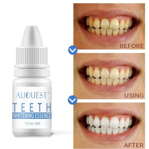 APINKGIRL Products For Teeth Whitening