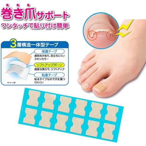 Ingrown Toenail Corrector Sticker Toe Nail Toenail Correction Treatment Pedicure Foot Care Stickers for Damaged Thick Black Nail