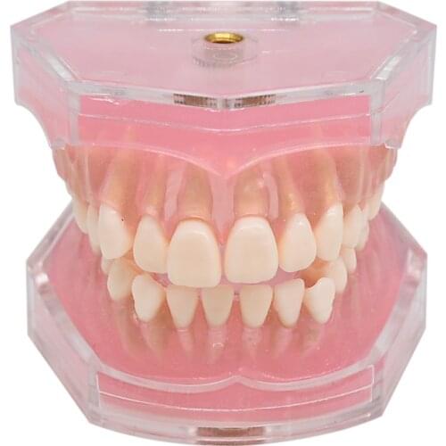 Dental Teaching Model Practice tooth extraction All teeth detachable Soft Teeth Gum Model Tooth Pull out Removable Dental Model