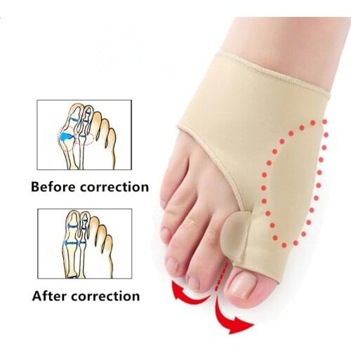 1Pair Big Bone Orthopedic Bunion Correction Pedicure Socks Silicone Hallux Valgus Corrector Braces Toes Separator Feet Care Tool