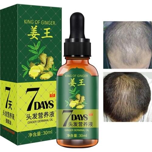 Hair Growth Serum Nourish Anti-Hair Loss Repair Anti-Dryness Natural Health Tocopherol Ginger Extract Unisex Hair Treatment 30ml