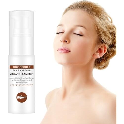 1pc VIBRANT GLAMOUR Practical gentle No irritation Crocodile Scar Repair Toner Water Removal Acne Scar Whitening Face Care tool