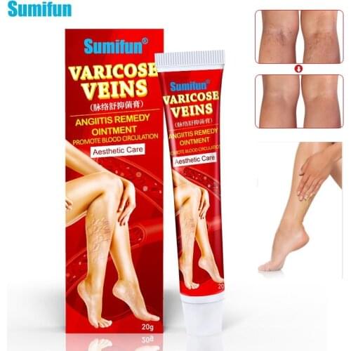 Sumifun 1Pcs Varicose Veins Treatment Cream 100% Original Vasculitis Phlebitis Spider Pain Relief Ointment Medical Plaster P1149