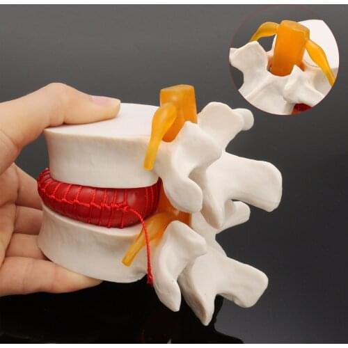 Human anatomy skeleton Spine Lumbar Disc Herniation Teaching Model brain skull traumatic pistol school supplies medical instrume