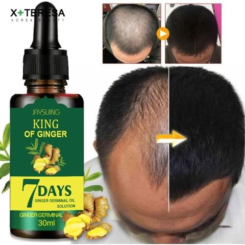 Ginger Essence Hair Growth Essential Oil Germinal Hair Growth Serum Essence Oil Hair Loss Treatment Growth Hair for Men Women
