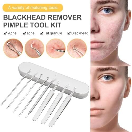 4 Pcs Stainless Steel Blackhead Remover Tool Kit Face Massage Whitehead Pimple Spot Comedone Acne Extractor Face Massager