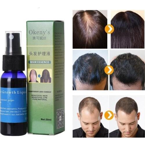 30ml Fast Growth Yuda Pilatory Spray Anti Baldness Hair Care Hair Loss Treatment Beard Oil Growing Facial Hair Stop Hair Loss