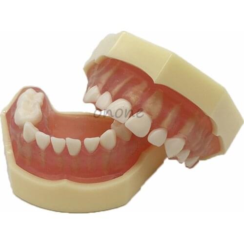 Dental Typodont Soft Gum mini Study Teeth Model with Removable Teeth Model Dental Study Teach Teeth Model