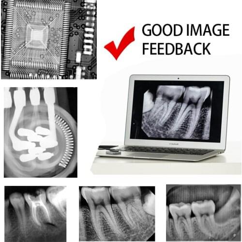 High Frequency Portable Imagaing System X Ray Dental Machine X-ray Camera Unit