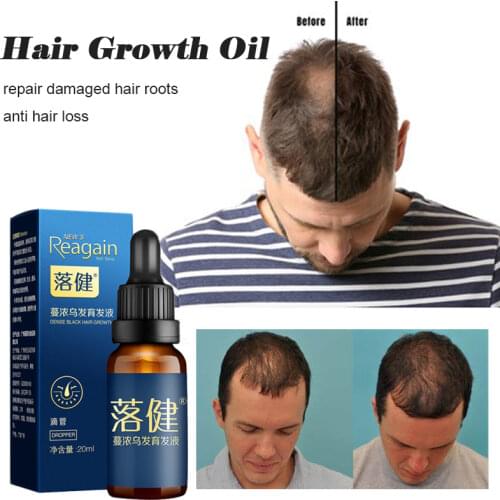 Hair Growth Anti Hair Loss Spray Repair Damage Hair Roots Tonic for Women/Men Dry Hair Regeneration Repair Hair Care Products
