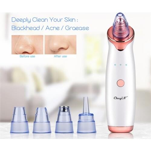 CkeyiN Blackhead Remover Facial Pore Vacuum Suction USB Rechargeable Cleansing Face Skin Care Dirt Acne Pore Cleaner Facial Tool