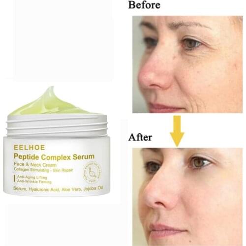 1pcs Peptide Serum Cream Acne Scar Removal cream For Face Anti-whrink Firming Brighting Whitening Cream Face Skin Care TSLM1