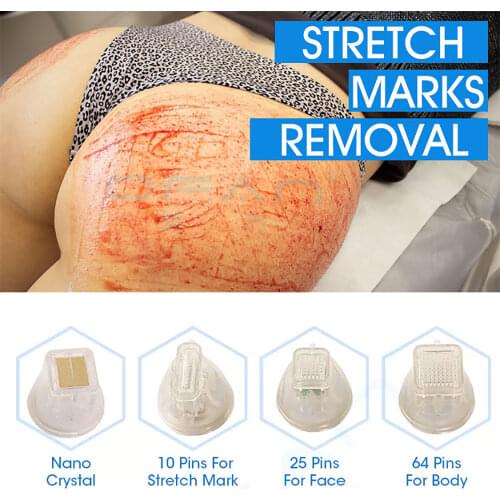 Cderella Mesoscooters