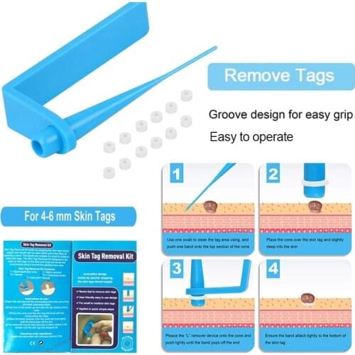 Micro Band Remove Skin Mole Wart Remover Blue Skin Tag Removal Kit Non Toxic Face Care With Cleansing Swabs Home Use Adult